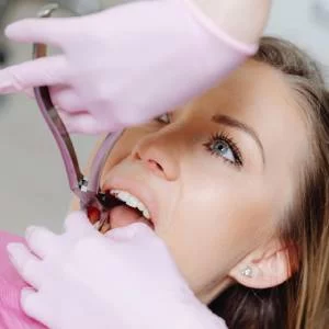Signs That You Need a Tooth Extraction: Recognizing the Warning Signs