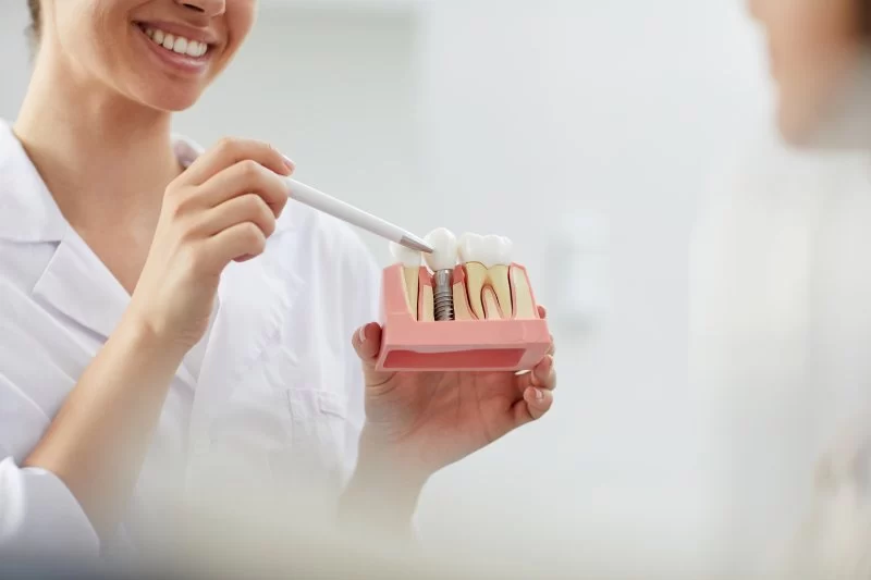 What to Expect During a Dental Consultation for Implants: A Complete Guide
