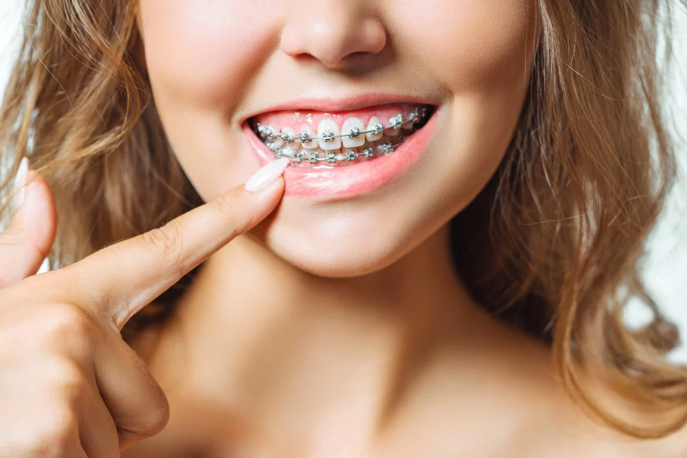 How to Maintain Your Oral Health During Orthodontic Treatment: Tips for Braces Care