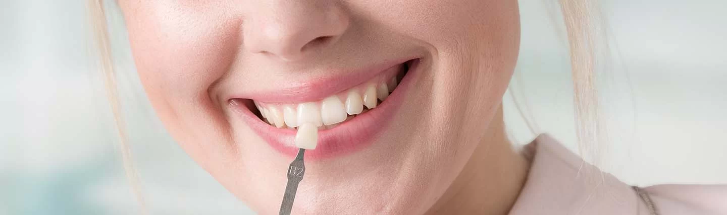 How Much Do Dental Veneers Cost Per Tooth? A Complete Guide to Understanding Pricing and Options