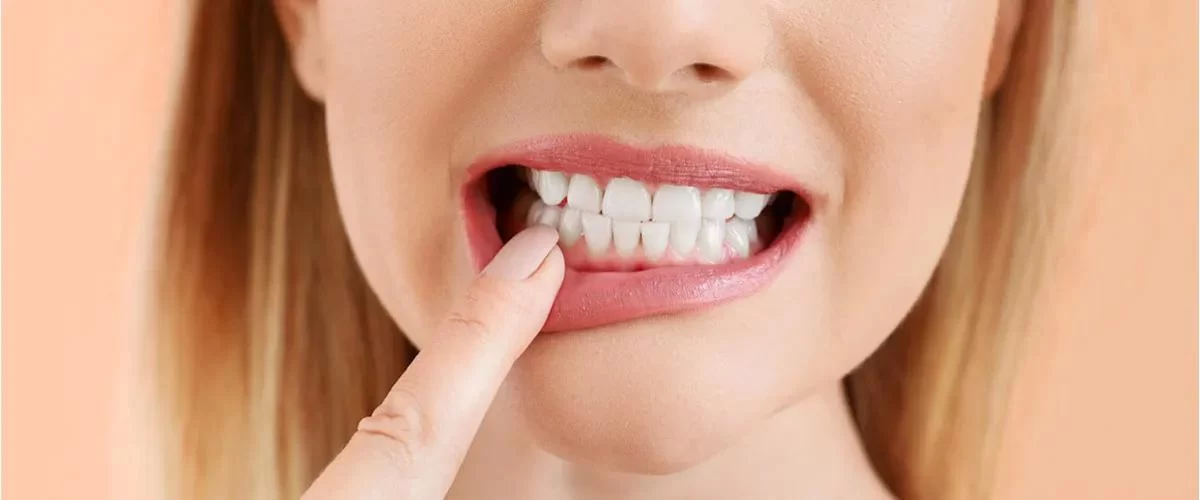 Tooth Enamel Erosion Prevention: How to Protect and Strengthen Your Enamel