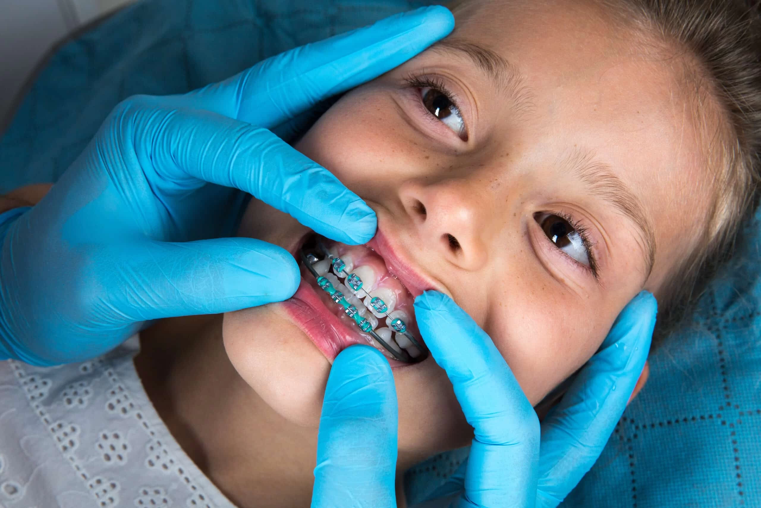Kids Orthodontics: Everything Parents Need to Know About Early Orthodontic Care