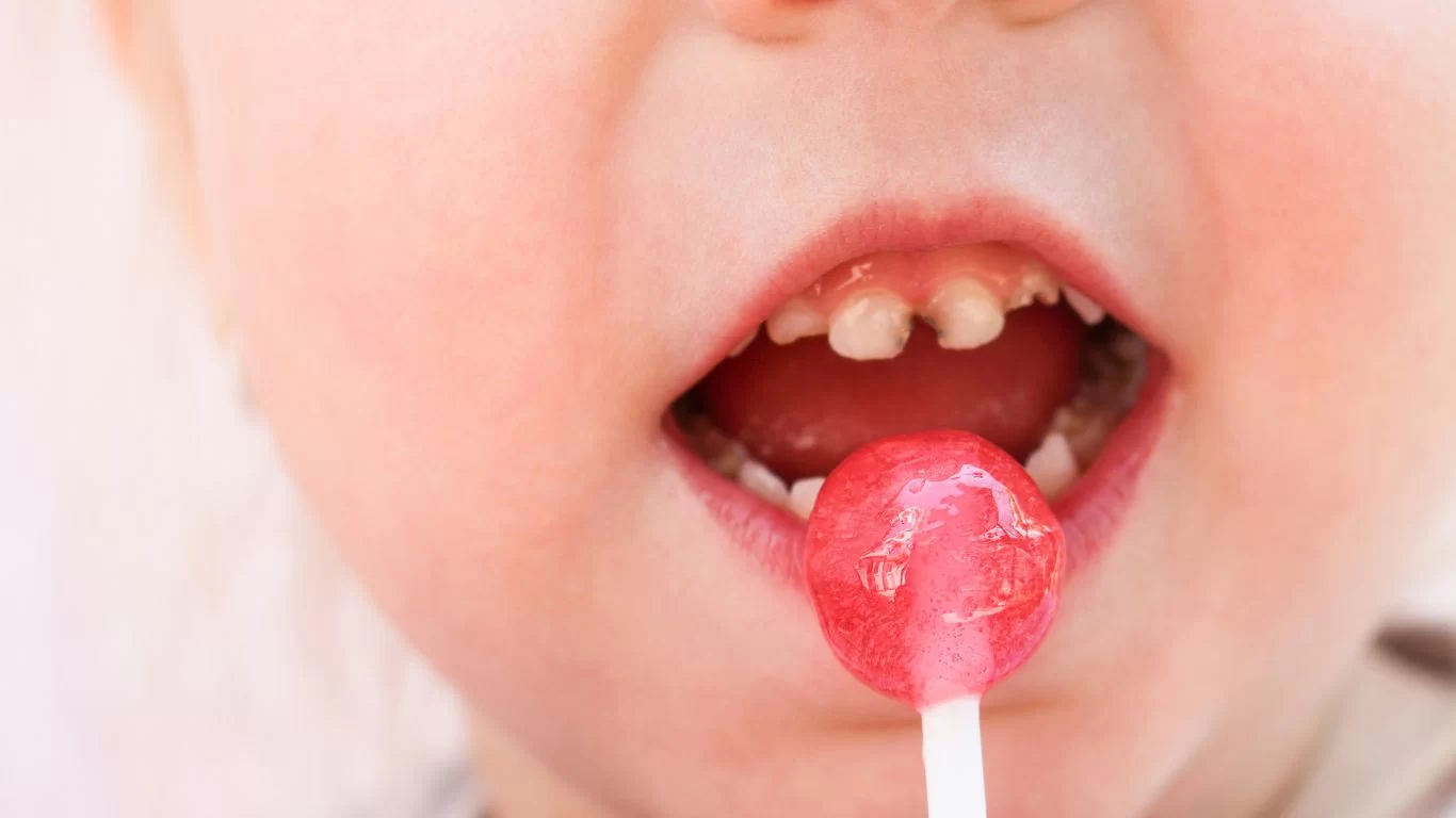How to Prevent Early Childhood Cavities: Essential Tips for Parents