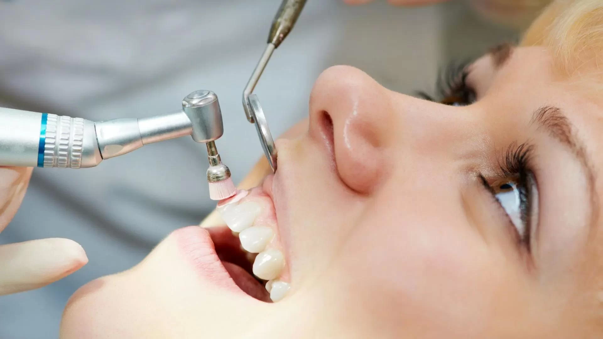 How Often Should You Get a Dental Check-Up? Understanding the Right Frequency for Optimal Oral Health