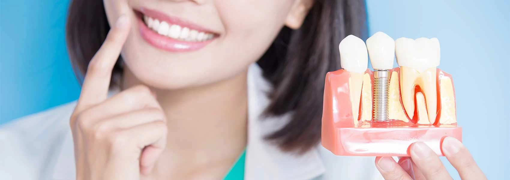 How Long Do Dental Implants Last and When to Replace Them? A Complete Guide