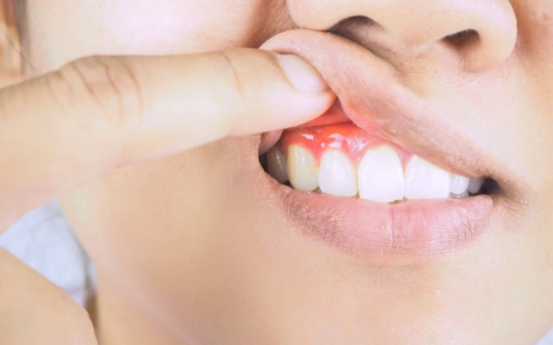 How to Prevent Gum Disease with Better Oral Care: Essential Tips for Healthy Gums