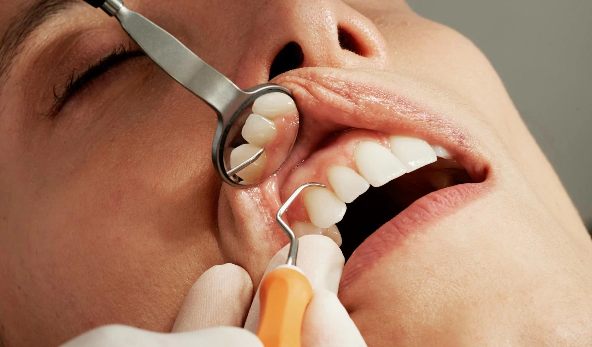 How to Manage the Pain of an Abscessed Tooth: Tips and Remedies for Relief