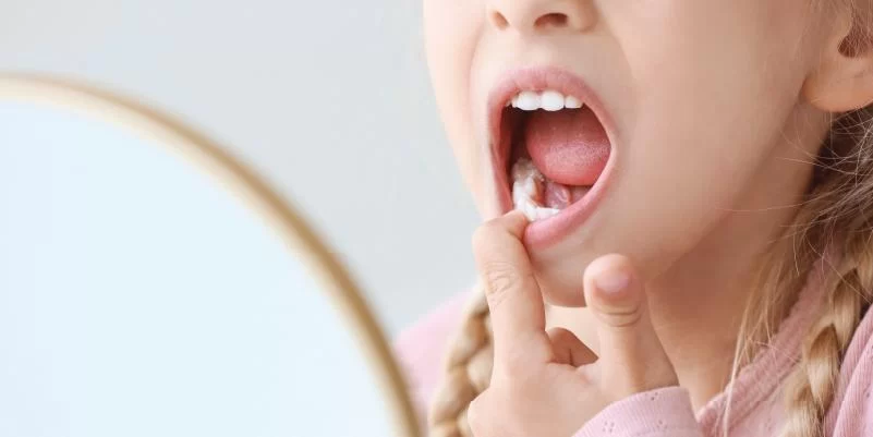 Can Gum Disease Cause a Sore Throat and Hoarseness? Learn the Link and How to Prevent It
