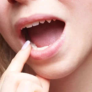 Can Gum Disease Cause a Sore Throat and Hoarseness? Exploring the Link