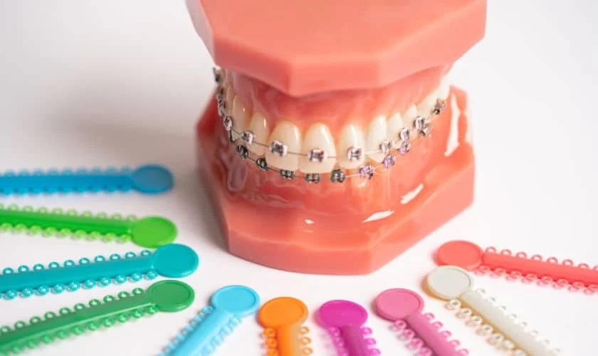 When to Start Orthodontic Care for Kids: Timing, Treatments, and Benefits