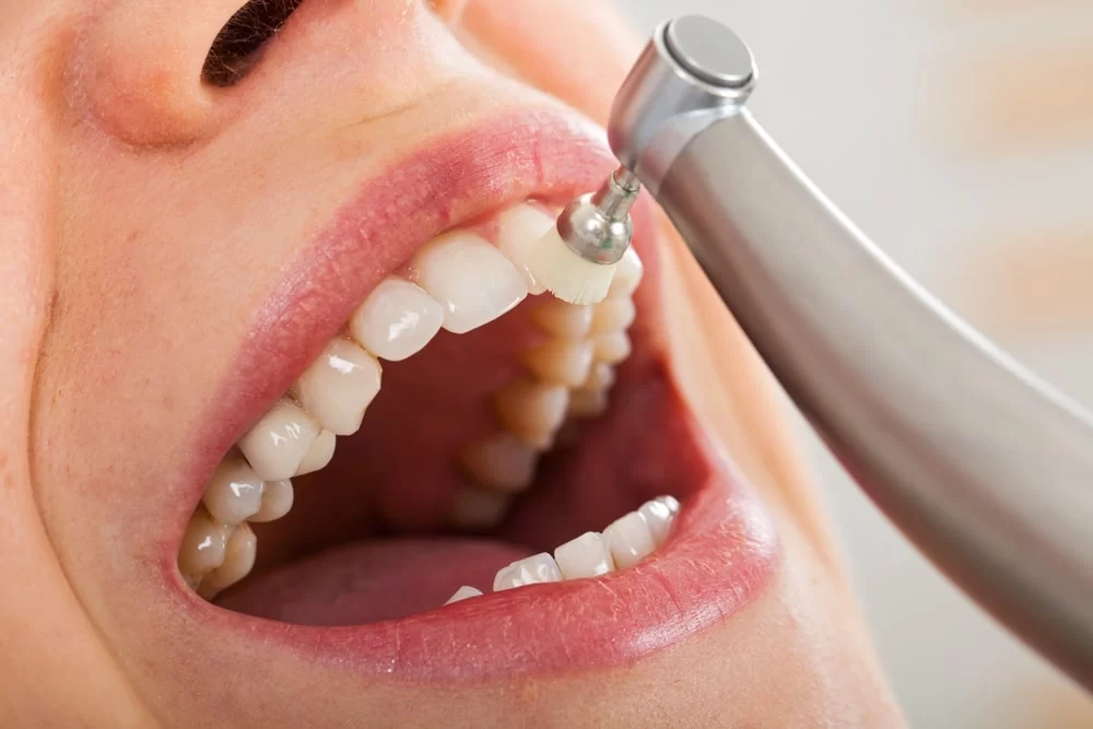Why Regular Dental Cleanings Are Essential for Your Oral Health