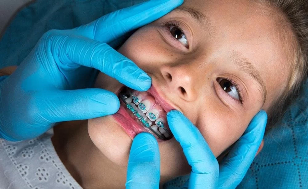 How to Effectively Manage Dental Problems with Kids' Braces