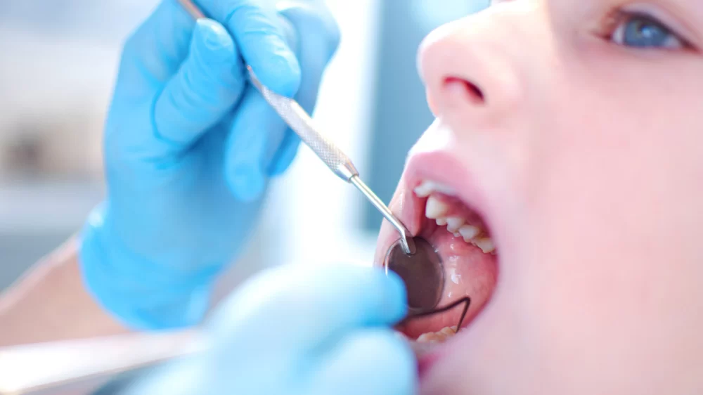 How to Prevent Long-Term Dental Problems in Kids: Essential Tips for Parents