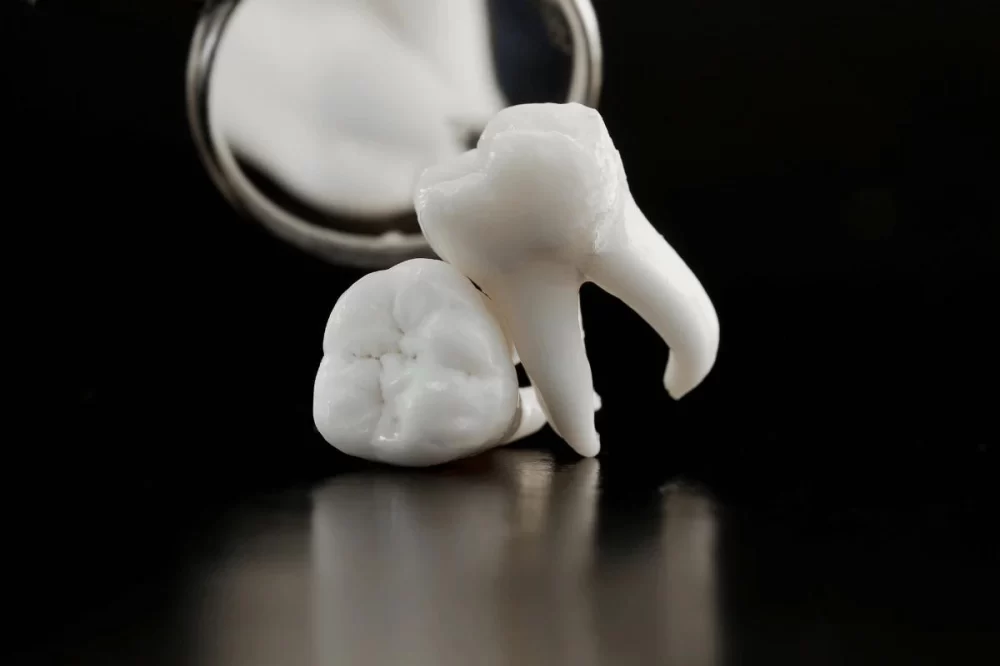 What Is Dental Pulp Therapy and When It’s Needed? A Complete Guide to Pulp Treatment