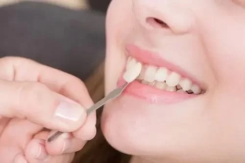 How to Fix Crooked Teeth Without Braces – Natural and Effective Solutions