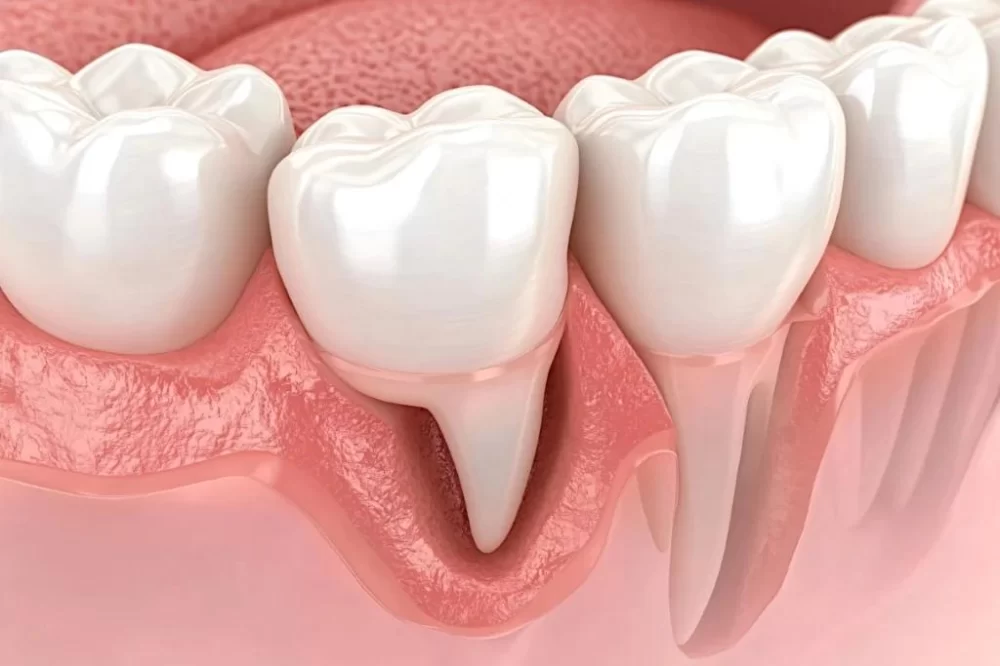 How Does Untreated Gum Disease Affect Your Teeth? Exploring the Risks and Consequences