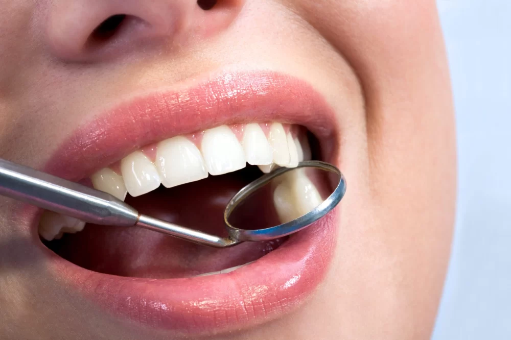 The Benefits of Dental Discount Plans: Affordable Care for Your Smile