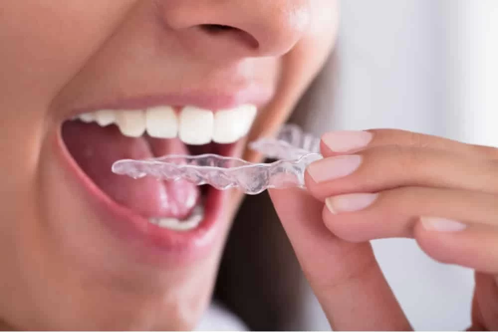 Causes and Treatments for Sensitive Teeth: Effective Solutions for Tooth Sensitivity