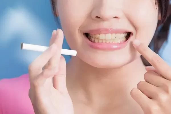 The Effects of Smoking on Oral Health: Why You Should Care About Your Smile
