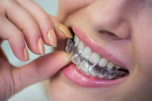 How to Use Dental Insurance for Braces: A Comprehensive Guide