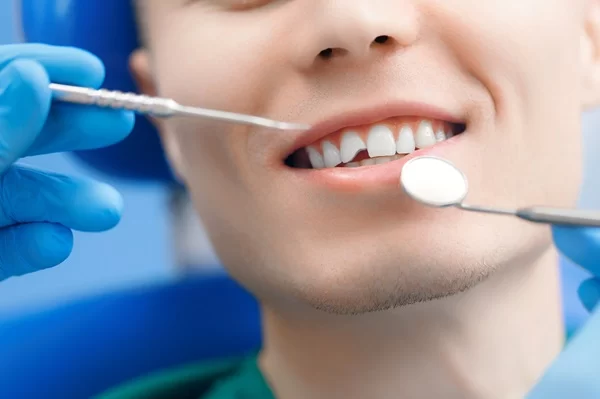 What to Do for a Cracked Tooth Before Treatment – Expert Advice