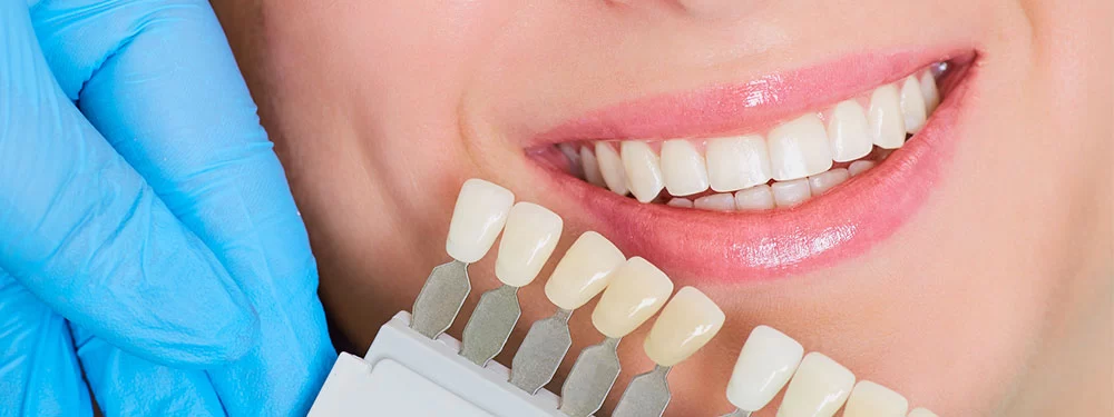 How Long Do Dental Restorations Last? Explore Lifespan and Maintenance Tips