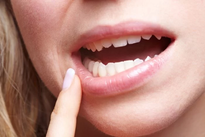 The Importance of Good Oral Hygiene for Gum Health: Protect Your Smile