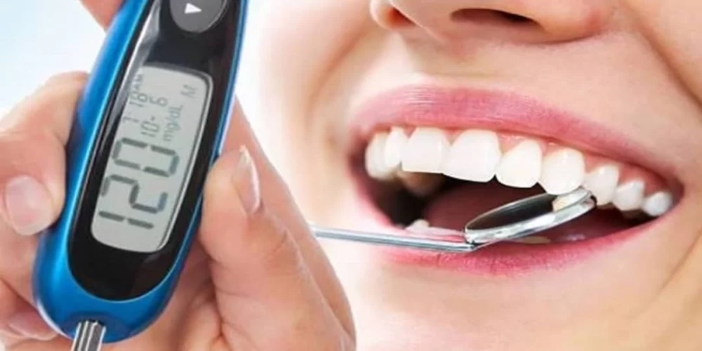 The Connection Between Oral Diseases and Diabetes Management