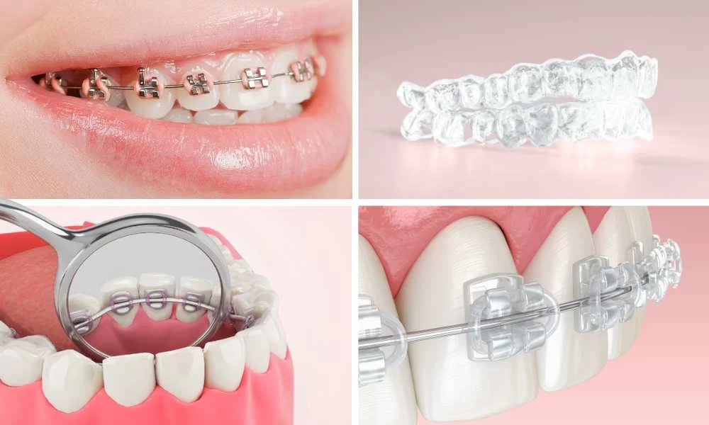 Top Dental Insurance Providers in the US: Find the Best Coverage for Your Smile