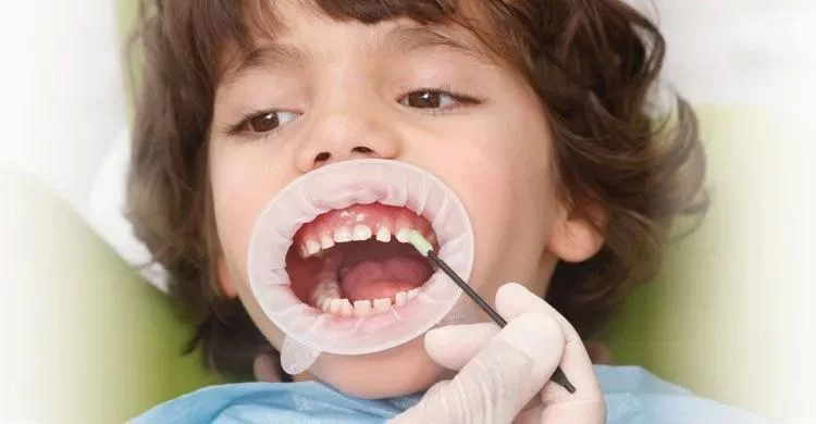 Benefits of Dental Fluoride Treatments for Kids: Protect Their Smile