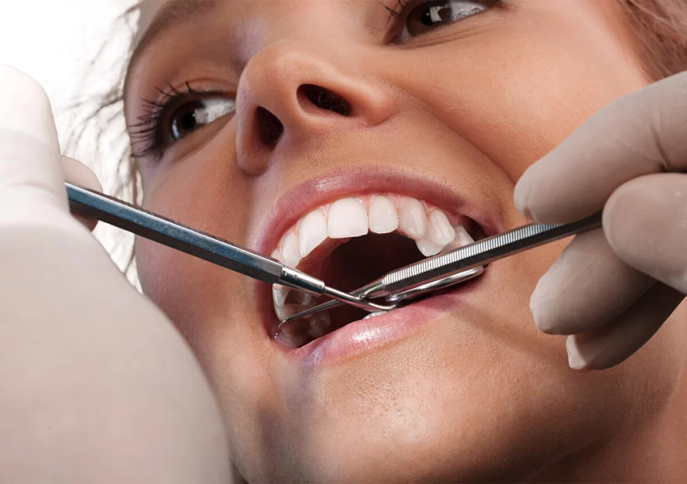 How to Prevent Teeth Stains with Proper Care: Simple Steps for a Bright Smile