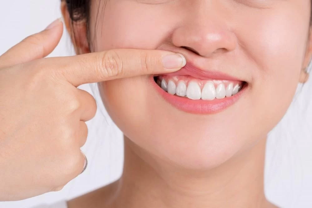 Antioxidants for Oral Health and Gum Protection: Boost Your Smile Naturally