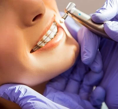 How Regular Dental Checkups Save You Money in the Long Run