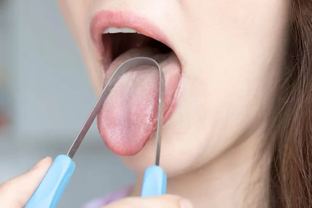 Proper Tongue-Cleaning Techniques for Optimal Oral Hygiene