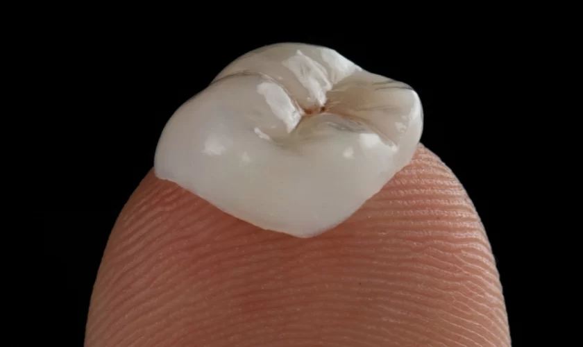 How to Avoid Dental Crowns with Proper Care: Tips for Maintaining Healthy Teeth