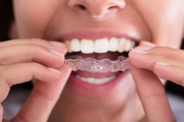 Why You Should Protect Your Teeth from Night Grinding