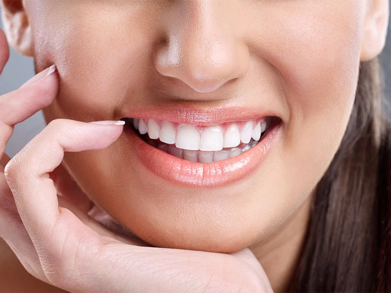 Top Tooth Whitening Services in Portland, OR: Your Guide to Professional Teeth Whitening