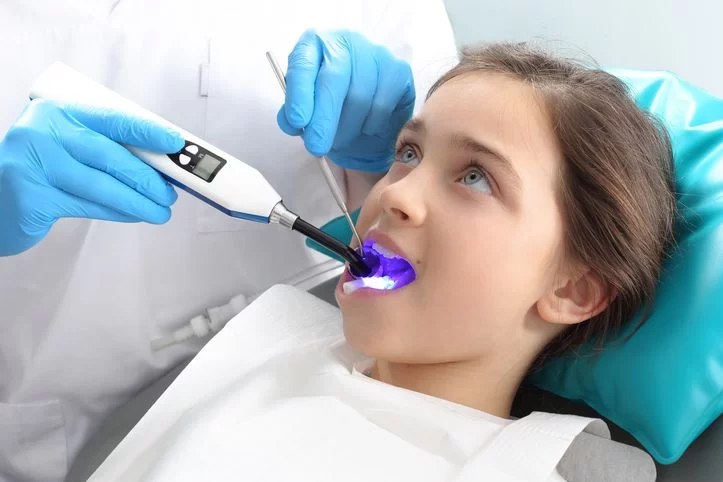 What Are the Benefits of Dental Sealants for Children? Protecting Their Teeth from Cavities