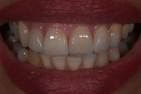 Burnaby Heights Dental Centre Picture 4