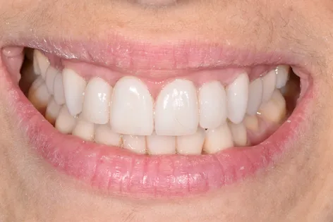 Burnaby Heights Dental Centre Picture 1