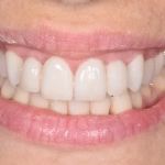 Burnaby Heights Dental Centre
