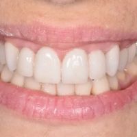 Burnaby Heights Dental Centre ico