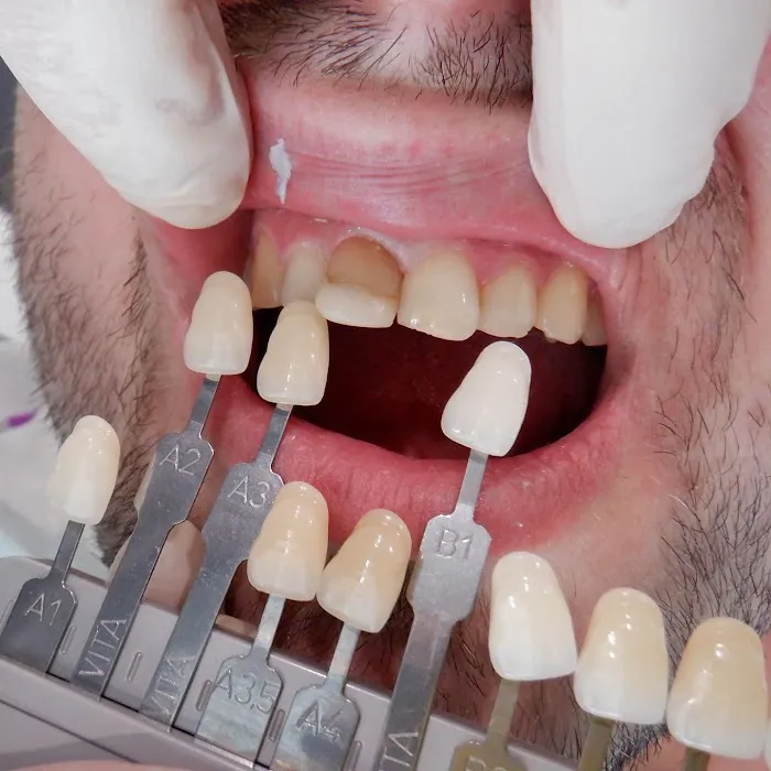 Dentist New Westminster Picture 9