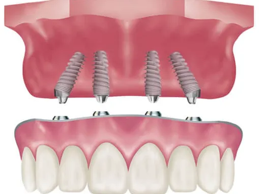 Burnaby Square Dental Picture 6