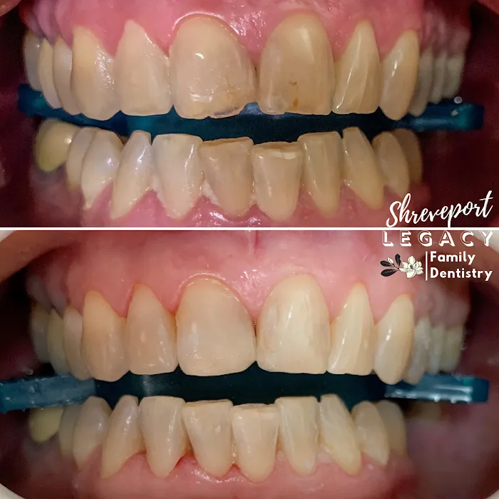 Shreveport Legacy Family Dentistry Picture 10