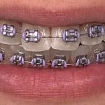 Lakeshore Dental Specialists