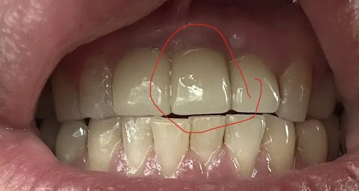 Purpose Dental Picture 2
