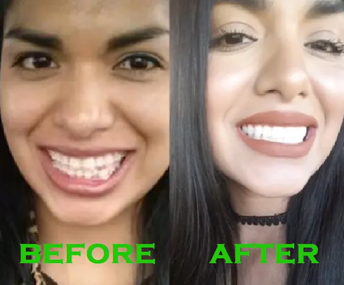 Ocean Ranch Dentistry - Oceanside, CA Picture 9