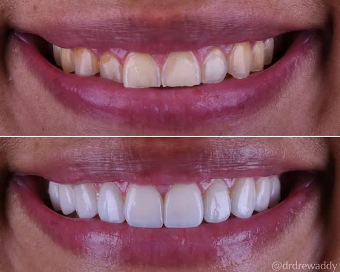 Carlsbad Beach Dental - Drew Addy, DDS Picture 10