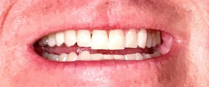Ramona Family Dentistry Picture 1